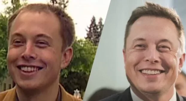 Trasformazione dei capelli di Elon Musk
